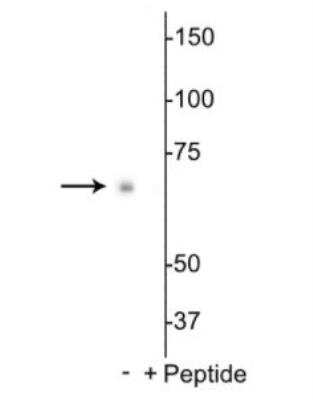 Western Blot: p70 S6 Kinase/S6K [p Ser398] Antibody [NBP3-11950]